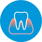 Periodontia (Tratamento Gengival)