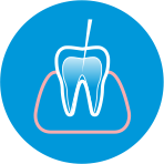 Endodontia (Tratamentos de Canal)